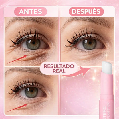 EyeLift Pro® Barra Rejuvenecedora de Retinol