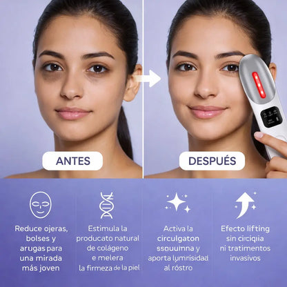 LumiLift® Rejuvenecimiento con Tecnología Inteligente
