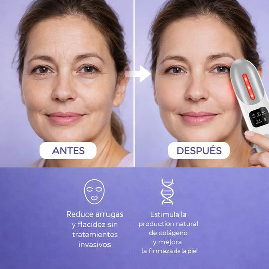LumiLift® Rejuvenecimiento con Tecnología Inteligente