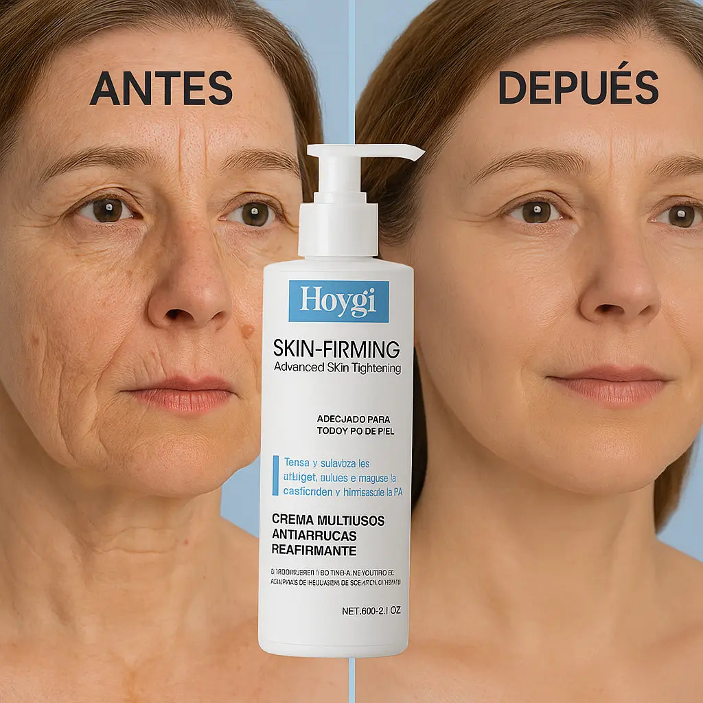 DermaLisse Crema Reafirmante