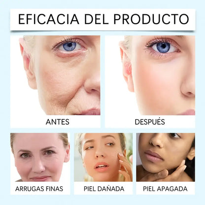 DermaLisse Crema Reafirmante